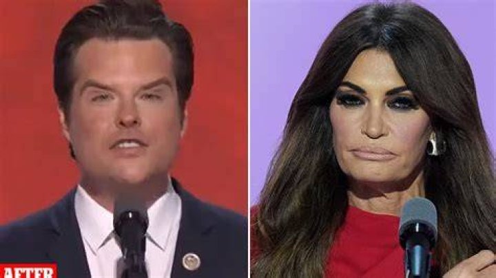 Unveiling The Transformation: Kimberly Guilfoyle's Plastic Surgery Journey Before And After